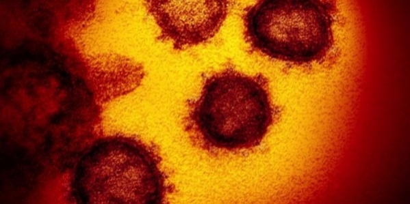 7_coronavirus_altri_due_contagi_in_campania_negativi_ventiquattro_tamponi.jpg